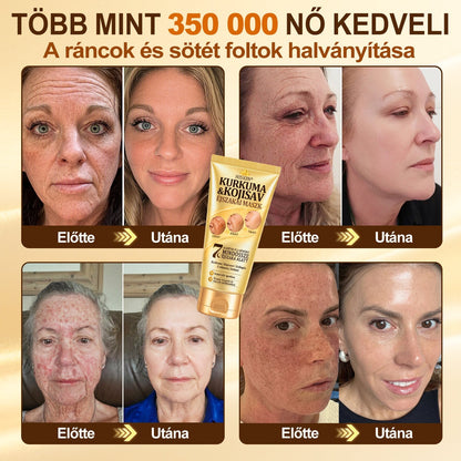 𝑯𝒊𝒗𝒂𝒕𝒂𝒍𝒐𝒔 𝑼̈𝒛𝒍𝒆𝒕 | 𝐔́𝐣! ✨ 𝐇𝐢𝐬𝐤𝐢𝐧® 𝐊𝐮𝐫𝐤𝐮𝐦𝐚 × 𝐊𝐨𝐣𝐢𝐧𝐬𝐚𝐯 𝐄́𝐣𝐬𝐳𝐚𝐤𝐚𝐢 𝐋𝐞𝐡𝐮́𝐳𝐡𝐚𝐭𝐨́ 𝐌𝐚𝐬𝐳𝐤 — 𝐇𝐚𝐥𝐯𝐚́𝐧𝐲𝐢́𝐭𝐬𝐝 𝐚 𝐦𝐚𝐤𝐚𝐜𝐬 𝐬𝐨̈𝐭𝐞́𝐭 𝐟𝐨𝐥𝐭𝐨𝐤𝐚𝐭 𝐞́𝐬 𝐬𝐢𝐦𝐢́𝐭𝐬𝐝 𝐤𝐢 𝐚 𝐥𝐚́𝐭𝐡𝐚𝐭𝐨́ 𝐫𝐚́𝐧𝐜𝐨𝐤𝐚𝐭 𝐚𝐥𝐯𝐚́𝐬 𝐤𝐨̈𝐳𝐛𝐞𝐧 🌙 ✅ 𝐄́𝐣𝐬𝐳𝐚𝐤𝐚́𝐧𝐤𝐞́𝐧𝐭 𝐞𝐠𝐲 𝐥𝐞́𝐩𝐞́𝐬 · 𝐋𝐚́𝐭𝐡𝐚𝐭𝐨́ 𝐯𝐚́𝐥𝐭𝐨𝐳𝐚́𝐬 𝟕 𝐞́𝐣𝐬𝐳𝐚𝐤𝐚 𝐚𝐥𝐚𝐭𝐭 💯